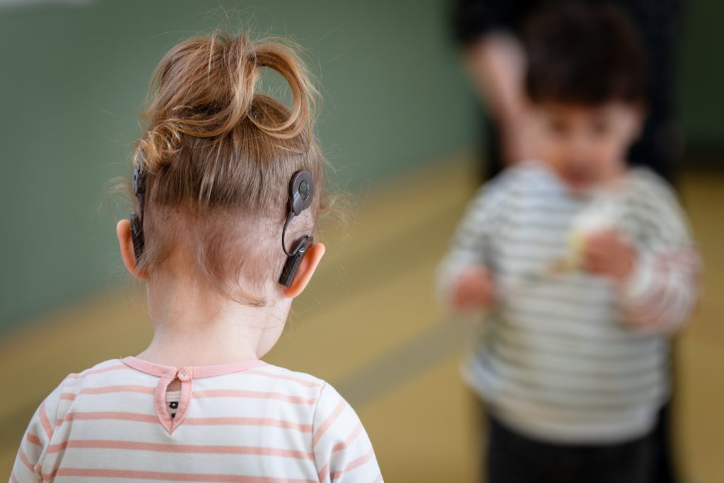 Hinterkopf eines jungen Mädchens. Oberhalb der Ohren ist jeweils der sichtbare Teil der Cochlea-Implantate zu erkennen.